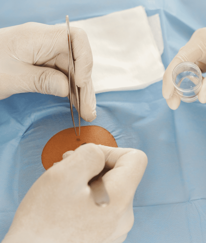 stock-photo-doctor-and-nurse-during-birthmark-removal-dermatologic-surgery-in-aesthetic-medical-clinic-2074848922-4-2