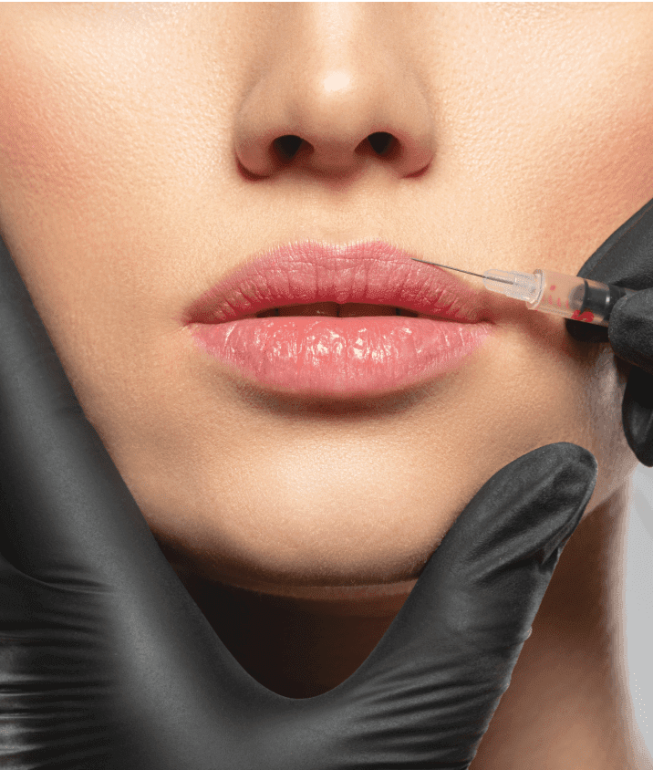 hjaluronski-fileri-min