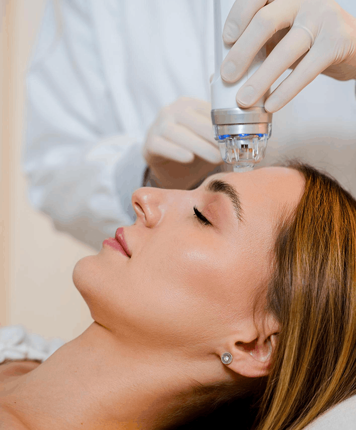 laserski-tretman-lica